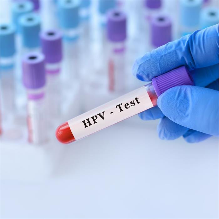 hpv test: come funziona e perché è importante farlo